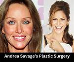 A Journey of Plastic Surgery