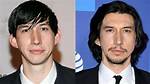Adam Driver's Ear Surgery: Before and After