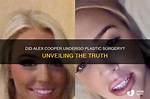 Alex Cooper Denied Rumors of Plastic Surgery