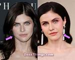 Alexandra Daddario's Plastic Surgery Journey Revealed