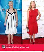 Alison Sweeney Plastic Surgery -Before and After Photos, Fans Suspect Her Facelift!