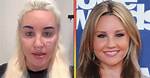 Amanda Bynes Mental Health Diagnosis, History of Depression and Anxiety – Is She in Psychiatric Hold?