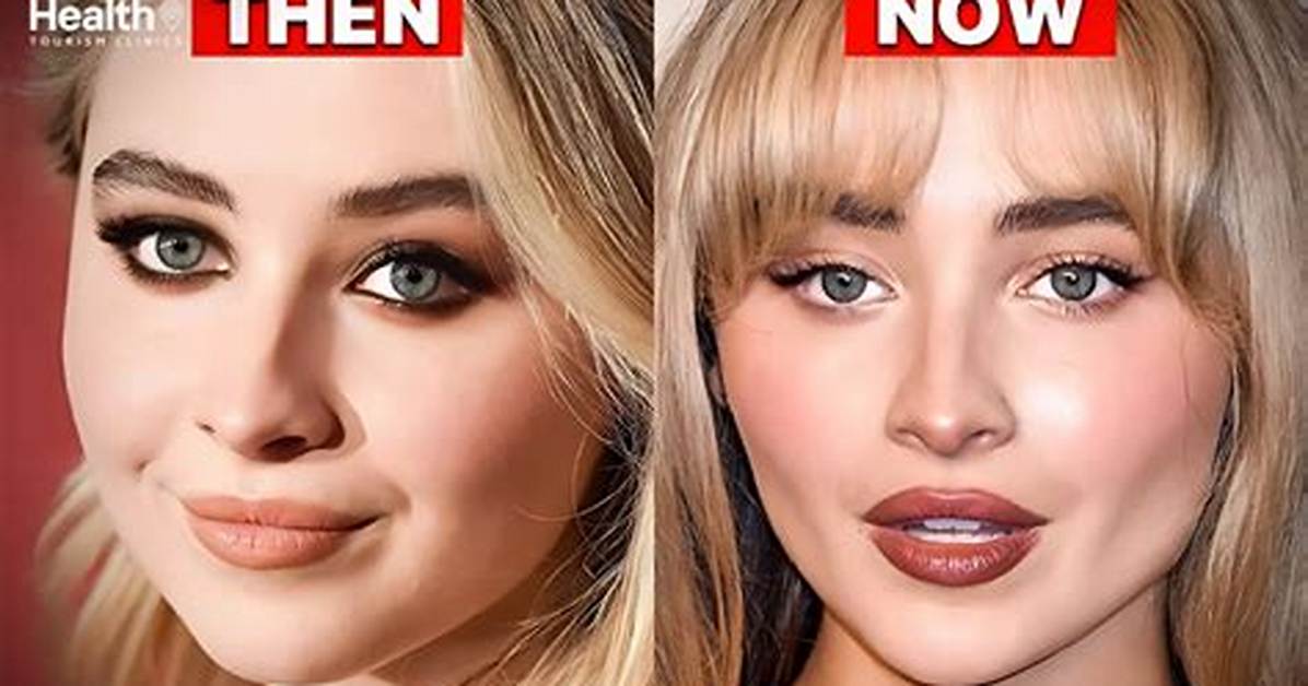 Analyzing Sabrina Carpenter's Transformation: Rumored Plastic Surgery