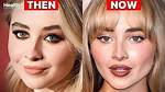 Analyzing Sabrina Carpenter's Transformation: Rumored Plastic Surgery