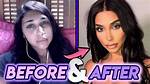 Chantel Jeffries Plastic Surgery Before and After: Did She Get a Nose and Lips Done