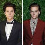 Cole Sprouse Teeth Before and After -Has He Used Braces and Whitened Them?