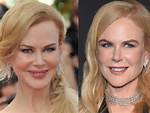 Did Nicole Kidman Get a Rhinoplasty? Explore the Transformation Rumors