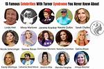 Discoveries in Actors with Turner Syndrome