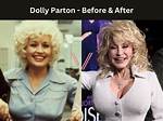 Dolly Parton: the Icon Beyond Her Breast Size
