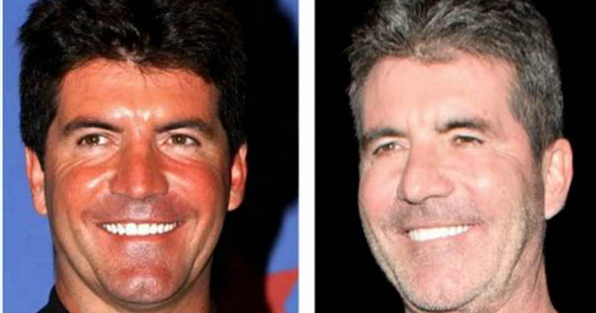 Exploring Simon Cowell's Journey: Is Simon Cowell's Son Autistic?