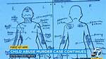 Gabriel Fernandez Crime Scene Photos | Death Cause and Murder Case
