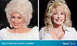 Has Dolly Parton Ever Had Plastic Surgery? How Many Plastic Surgery Has She Had?