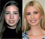 Has Ivanka Trump Had Plastic Surgery? Here's What Experts Say