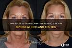 Has Jane Pauley Had Plastic Surgery? 71-Year's-Old Cbs Sunday Host Looks So Young for Her Age!