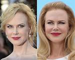 Has Nicole Kidman Had Breast Augmentation? Surgery Scrutiny and Truths
