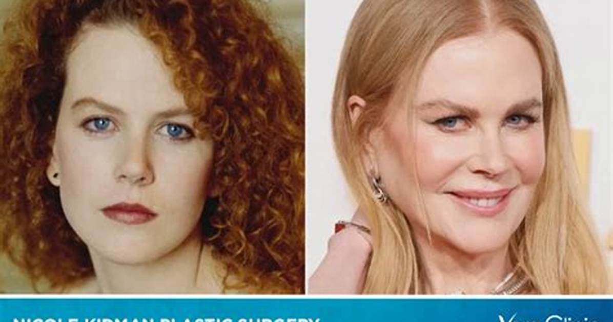 Hidden Truths About Nicole Kidman's Cosmetic Enhancements