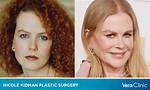 Hidden Truths About Nicole Kidman's Cosmetic Enhancements