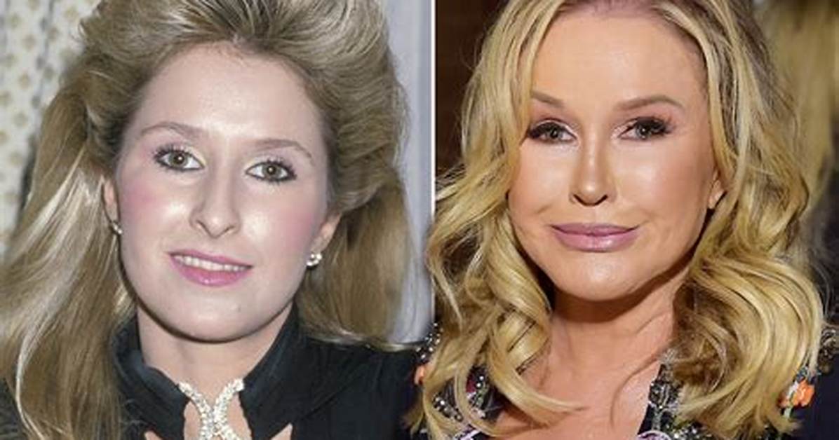 How Old Is Kathy Hilton? Unraveling the Mystery