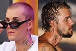 Justin Bieber's Shocking Hair Loss: Causes and Treatments