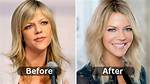 Kaitlin Olson Plastic Surgery Biography, Family, Career, History, Height
