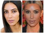 Kim Hieora | Done Plastic Surgery? Before and After Photo