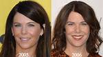 Lauren Graham's Plastic Surgery Journey Explored