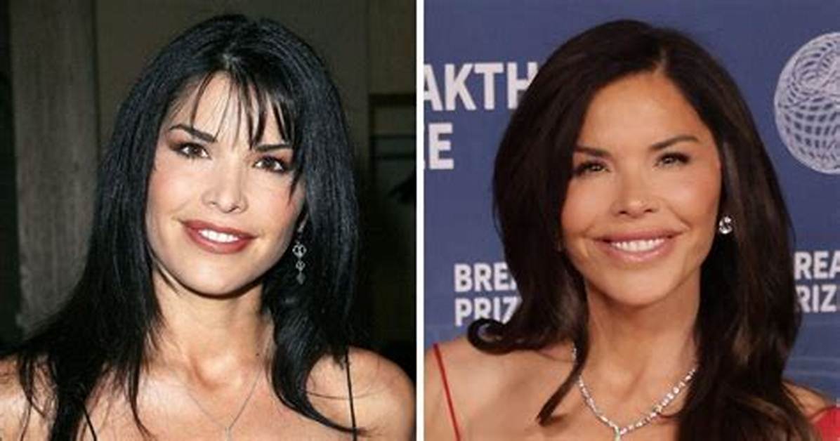 Lauren Sanchez Before and After Photos: Did Jeff Bezos’ Fiancee Undergo Plastic Surgery?