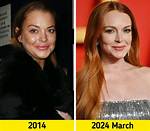 Lindsay Lohan's Plastic Surgery Transformation: a Closer Look