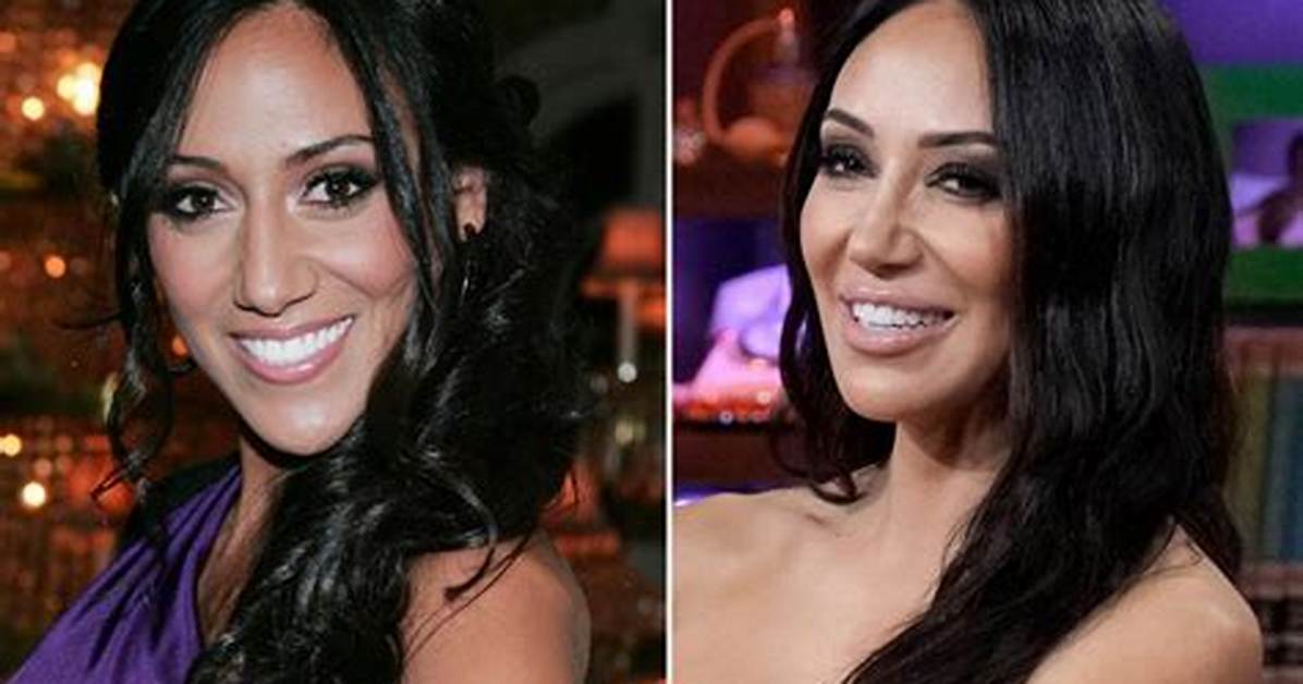 Melissa Gorga Claims Teresa Giudice Got Plastic Surgery on Forehead Hollywood Life ·