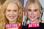Nicole Kidman: Beauty and Transformation Before Botox
