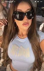 Onlyfans Star Mikaela Testa Goes Back and Forth on Plastic Surgery Claims