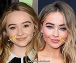 Sabrina Carpenter Nose Surgery: Transformation and Controversy