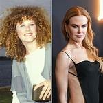 See the Drastic Transformation: Nicole Kidman's Plastic Surgery Journey