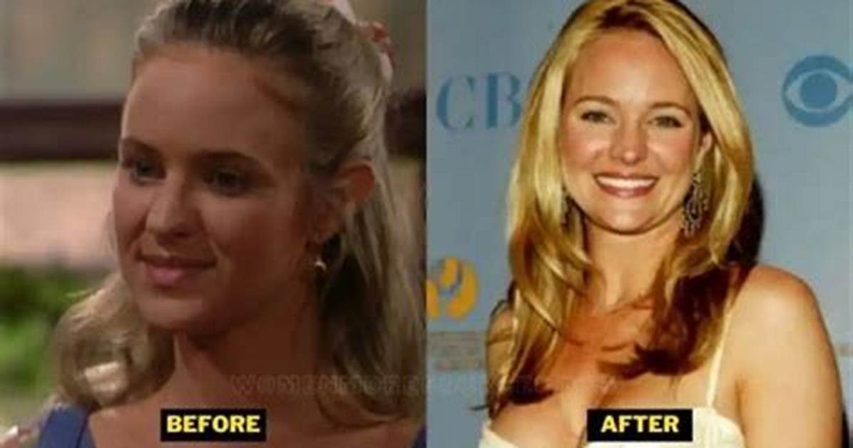 Sharon Case Face: the Allure Behind Her Timeless Beauty