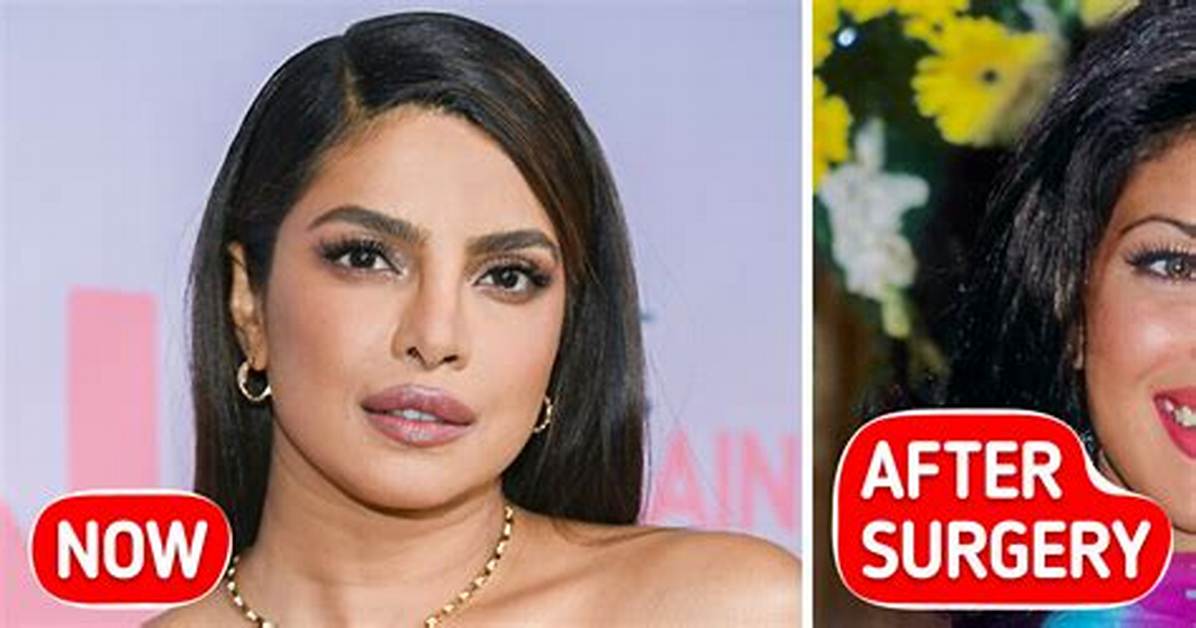 Sherlyn Chopra's Plastic Surgery Journey: Before and After
