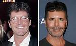 Simon Cowell Before and After Pictures What