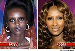 Skin Bleaching Practices Among Celebrities Revealed