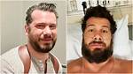 Steven Crowder Plastic Surgery: Separating Fact from Fiction