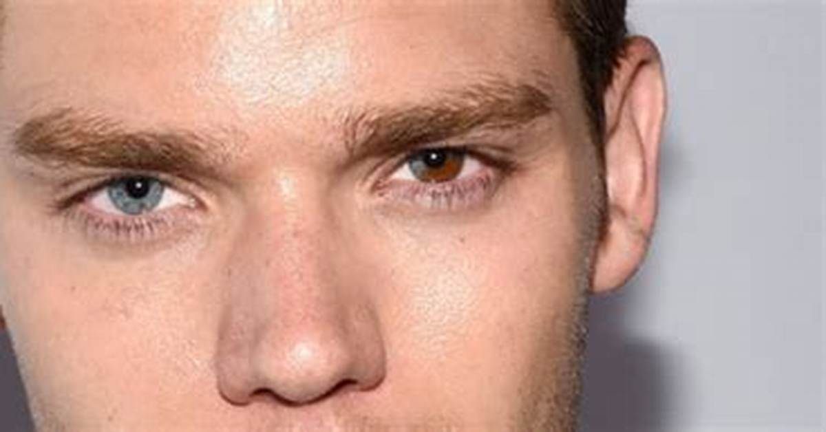 The Hidden Truth About Dominic Sherwood Eyes, Is Different Colored Pupils a Condition?