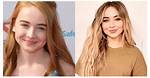 The Truth About Sabrina Carpenter's Natural Beauty: a Journey Without Plastic Surgery