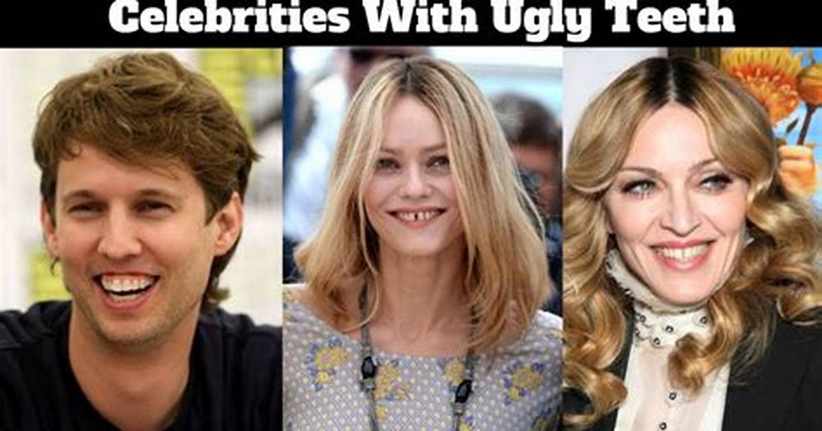 The Ugly Truth: Celebrities with Bad Teeth