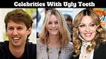 The Ugly Truth: Celebrities with Bad Teeth