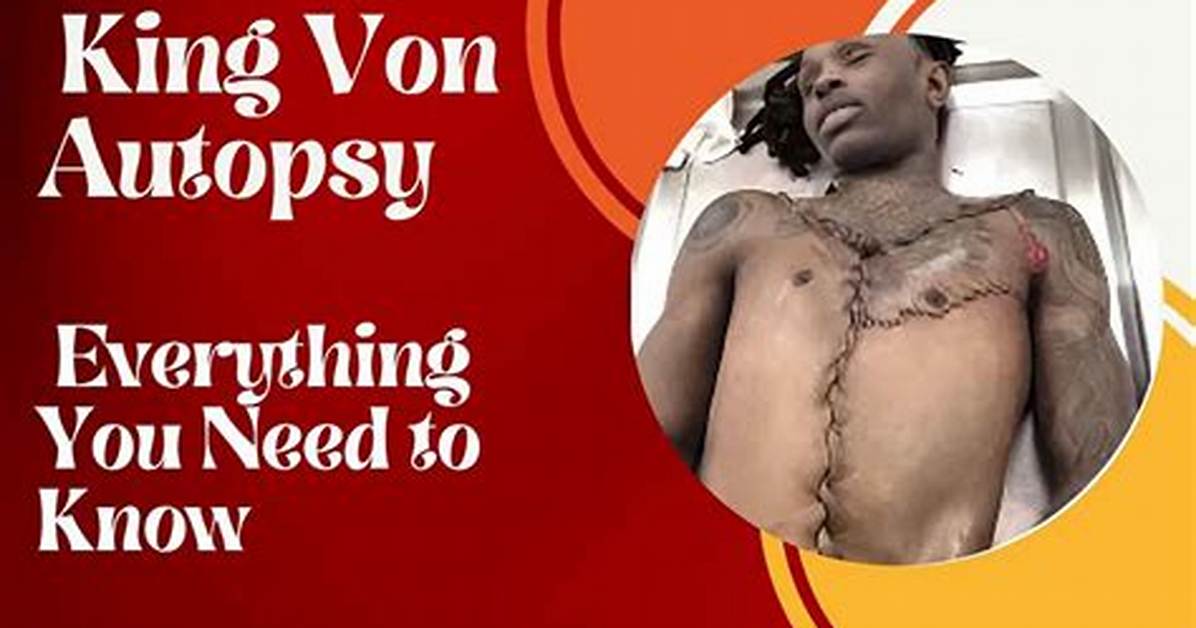 The Ultimate Guide to King Von Autopsy Report Details
