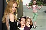 The Unfiltered Truth About Nicole Kidman's Filler Transformations