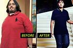 Transformative Journey: Anant Ambani's Weight Loss Surgery