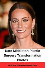 Uncover the Secrets Behind Kate's Surgery: Discoveries and Insights Revealed