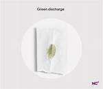 Understanding the Mystery of a Greenish Upper Lip