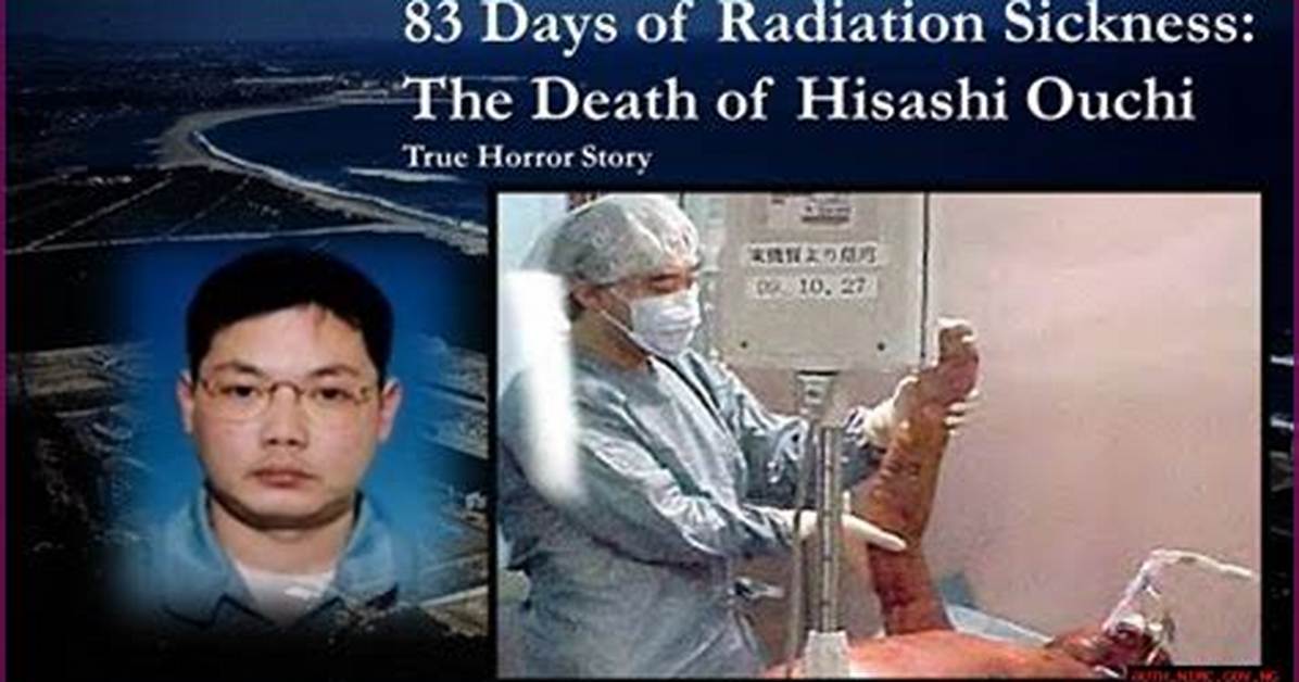 Understanding the Tragic Story of Hisashi Ouchi and Radiation Exposure