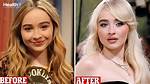 Unraveling Sabrina Carpenter's Plastic Surgery Whispers