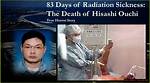 Unraveling the Tragic Tale of Hisashi Ouchi: the Man Whose Skin Fell Off